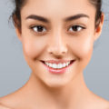 Vampire Facial Results